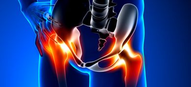 hip reconstruction