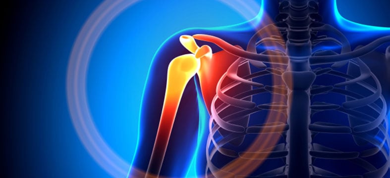 ny orthopedics shoulder testimonial