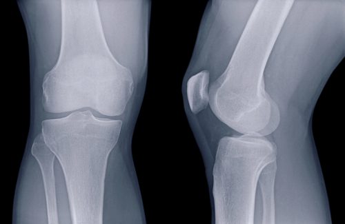 patellar tendon