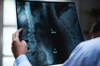Explore How Herniated Disc Injections Work to Relieve Your Back Pain - Blog Post