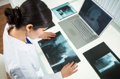 Relieve Pain With This Hip Replacement Approach - Blog Post